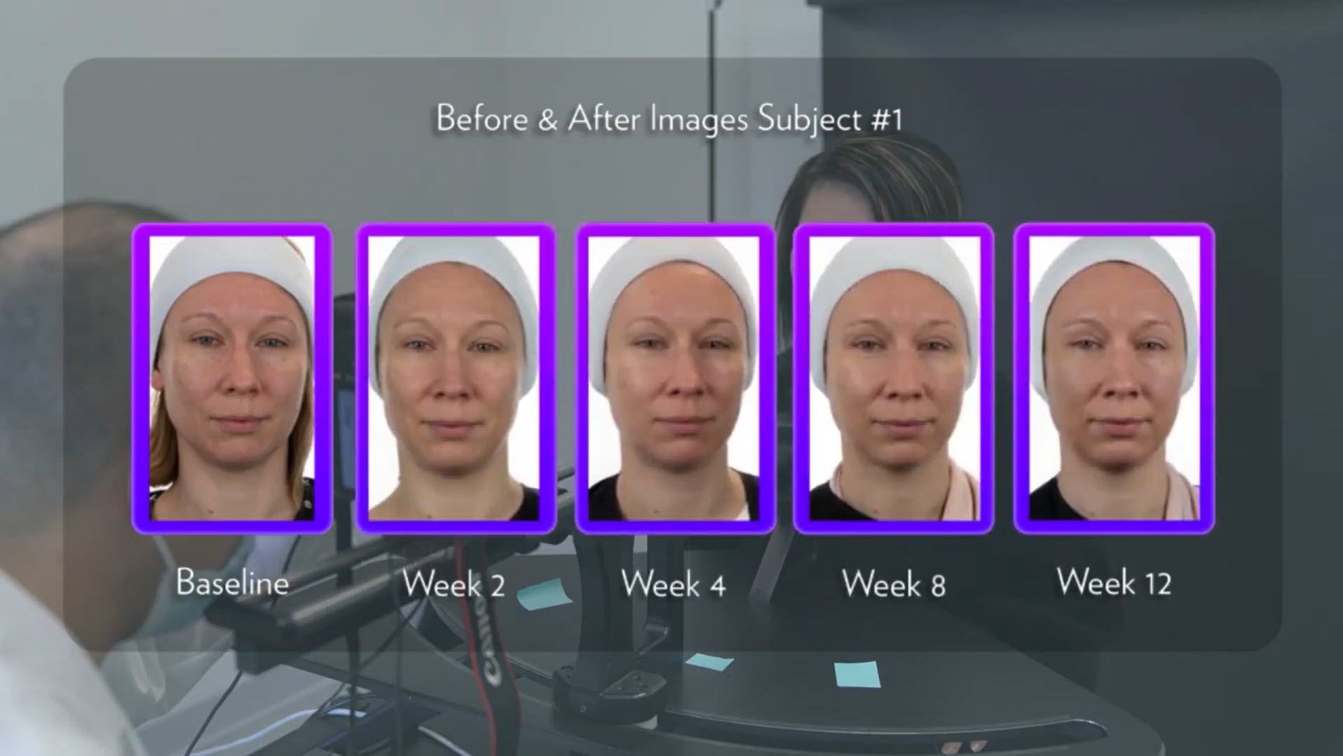 Before After 1