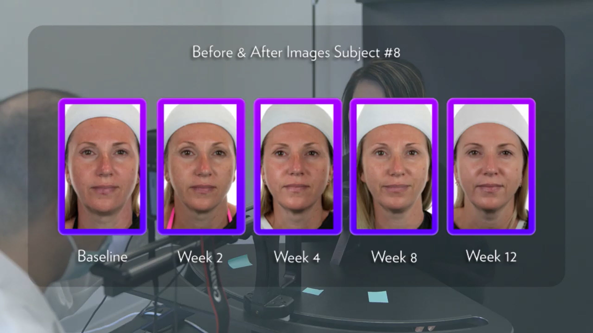 Before After 3