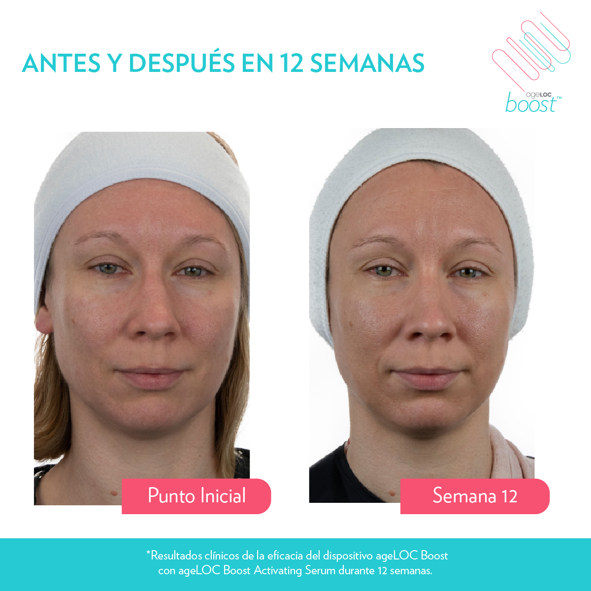 Boost 12 semanas BA 1
