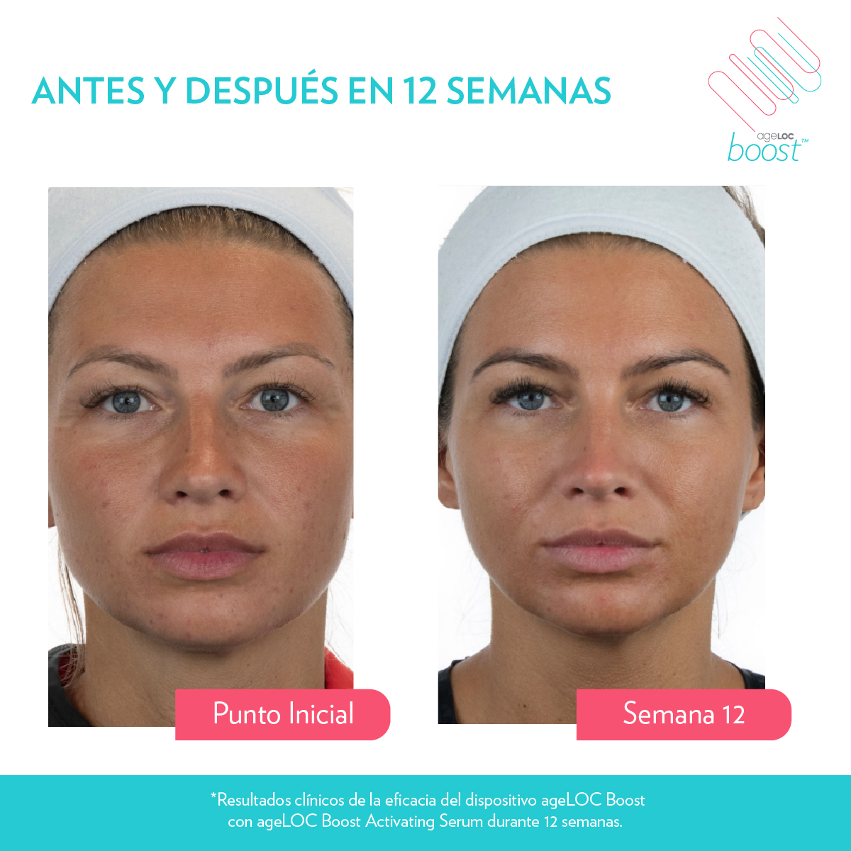 Boost 12 semanas BA 3